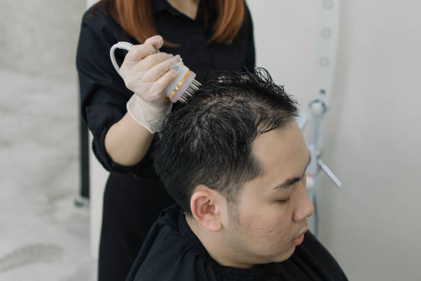 best hair restoration treatment in Dubai
