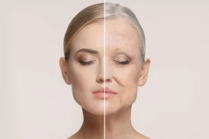 facial-aging-volume-loss