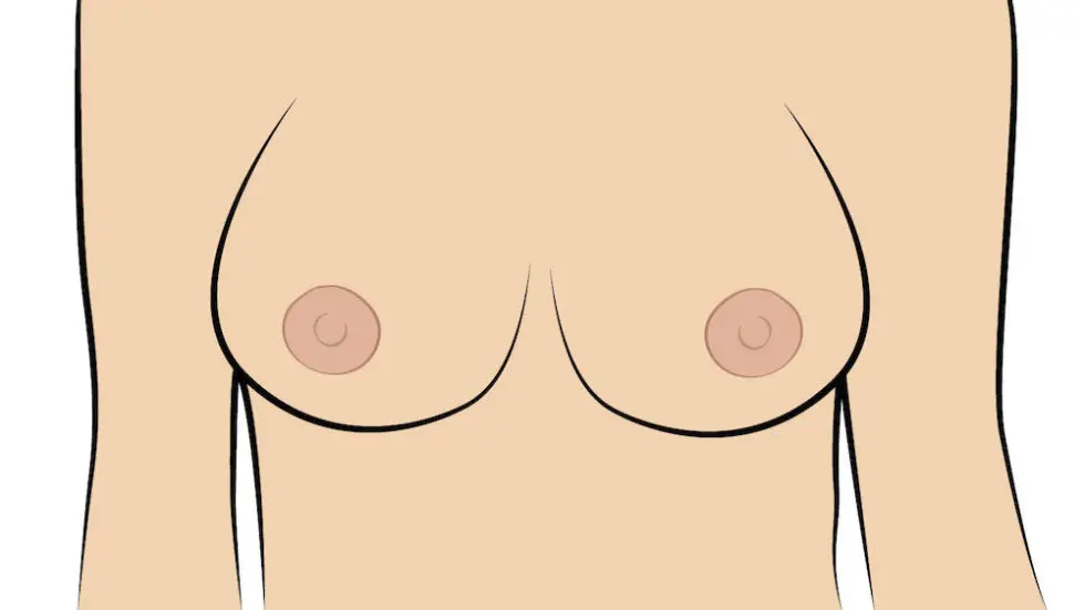 role-of-nipple-position-in-deciding-about-breast-lift-surgery